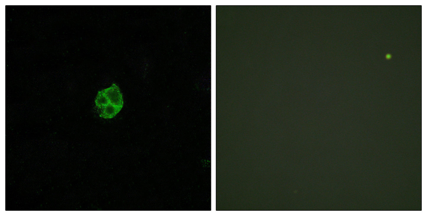 GPR151 Rabbit Polyclonal Antibody
