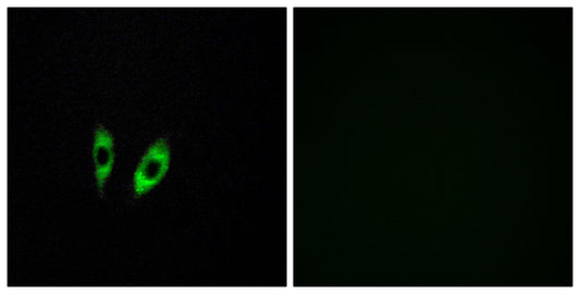 GPR156 Rabbit Polyclonal Antibody