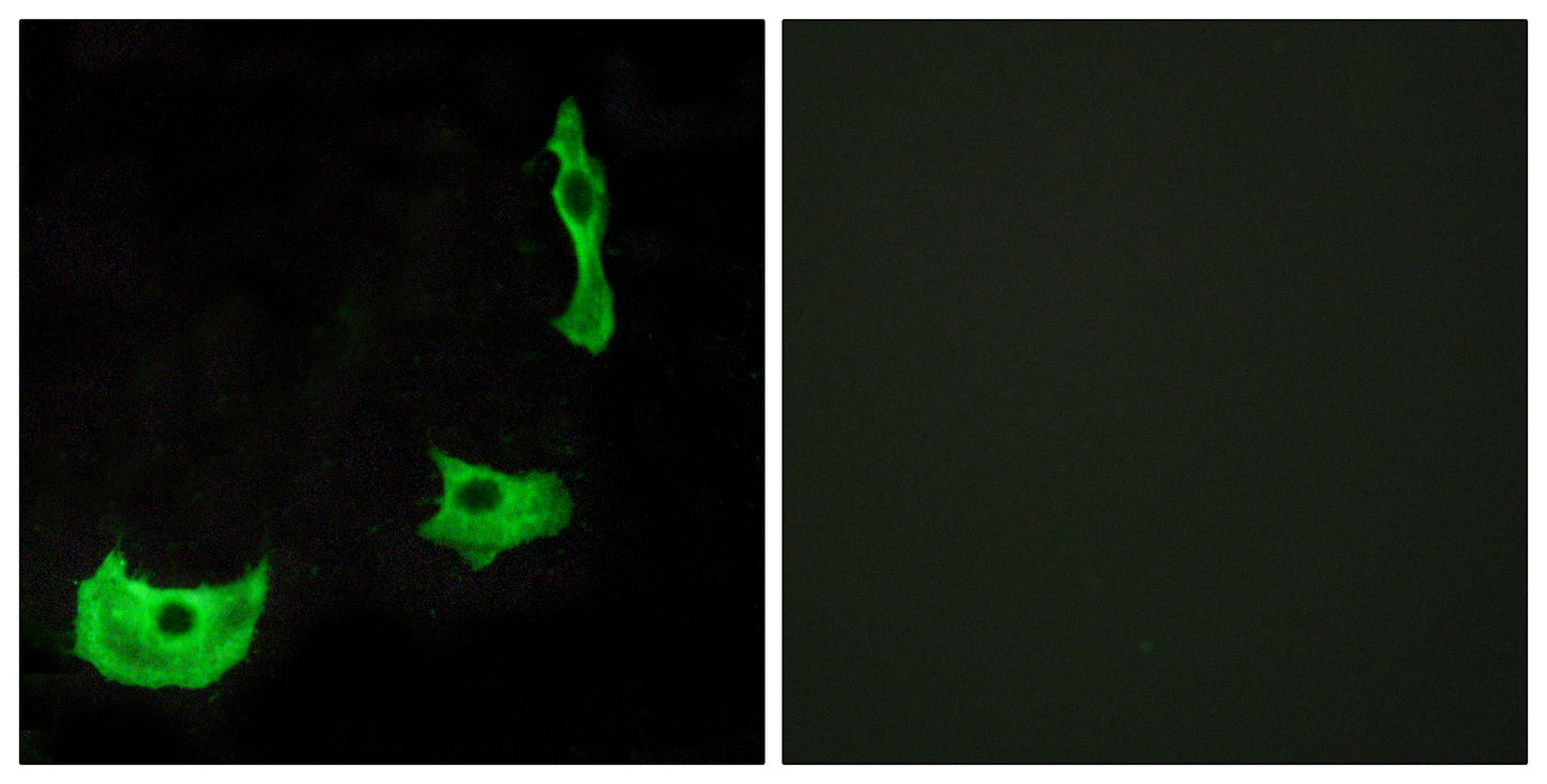 GPR17 Rabbit Polyclonal Antibody