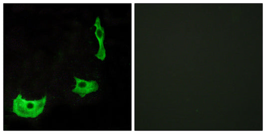 GPR17 Rabbit Polyclonal Antibody