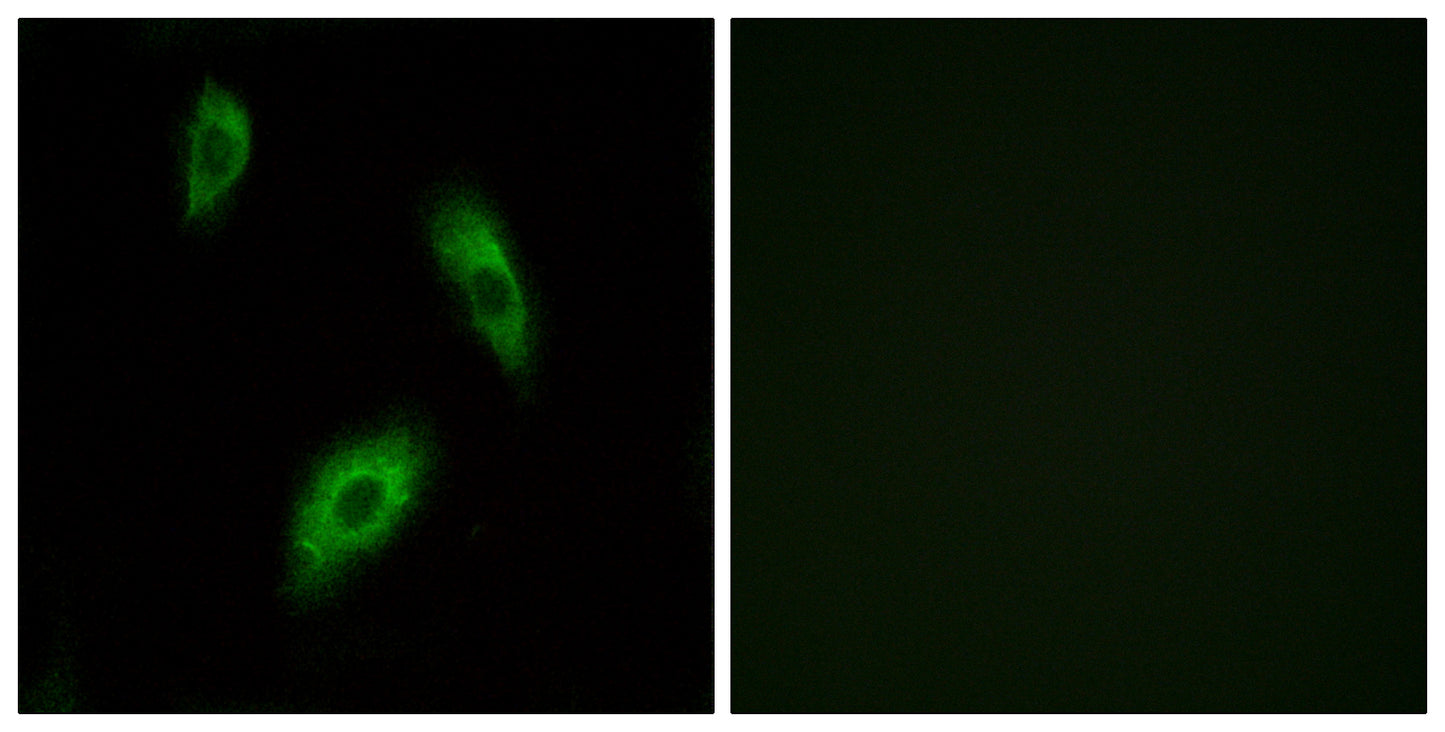 GPR174 Rabbit Polyclonal Antibody