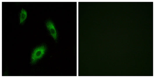 GPR174 Rabbit Polyclonal Antibody