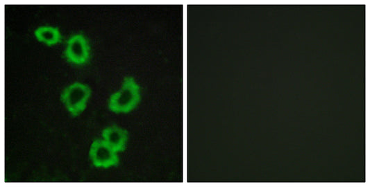 GPR176 Rabbit Polyclonal Antibody