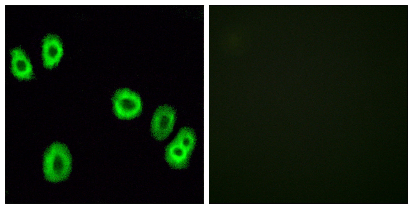 GPR18 Rabbit Polyclonal Antibody