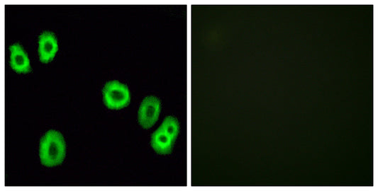 GPR18 Rabbit Polyclonal Antibody
