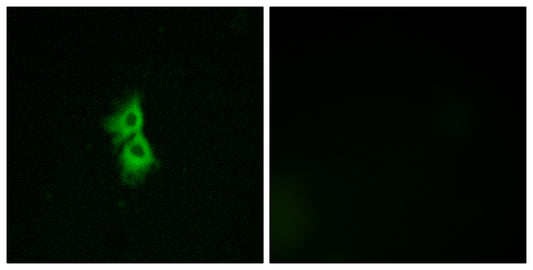 GPR22 Rabbit Polyclonal Antibody