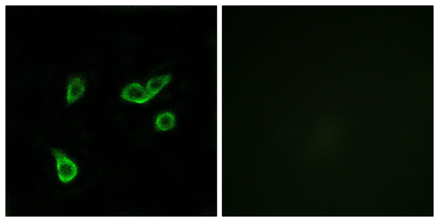 GPR35 Rabbit Polyclonal Antibody