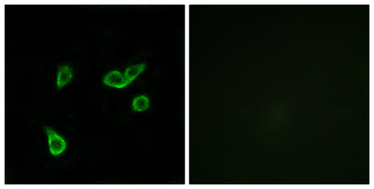 GPR35 Rabbit Polyclonal Antibody
