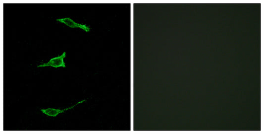 GPR40 Rabbit Polyclonal Antibody