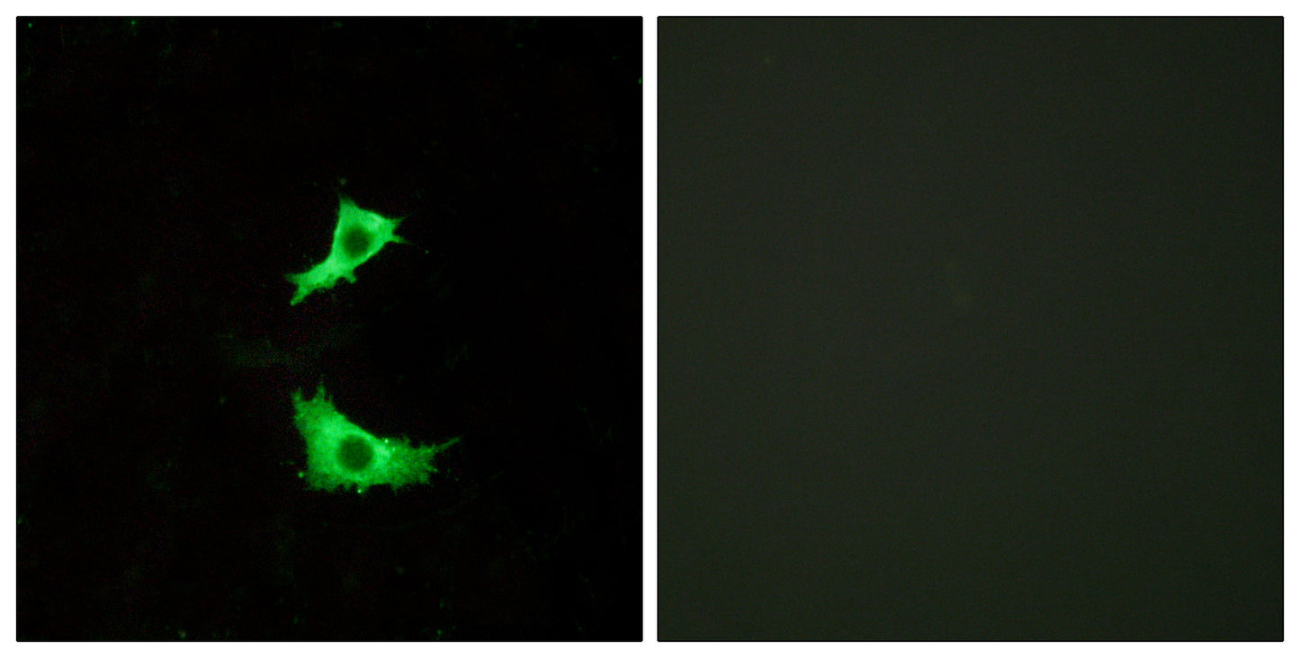 GPR41 Rabbit Polyclonal Antibody