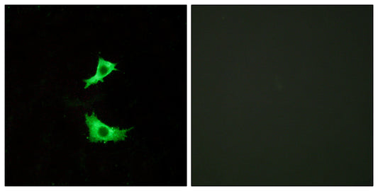 GPR41 Rabbit Polyclonal Antibody
