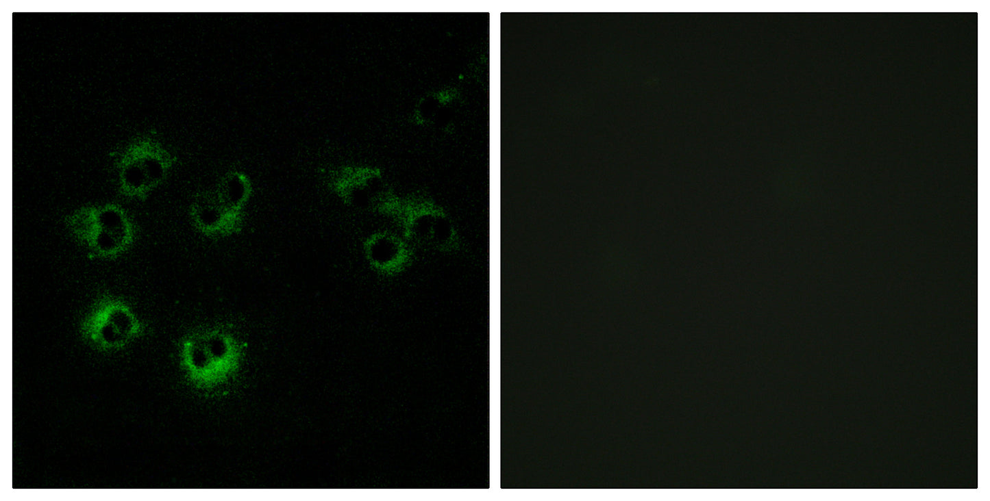 GPR42 Rabbit Polyclonal Antibody