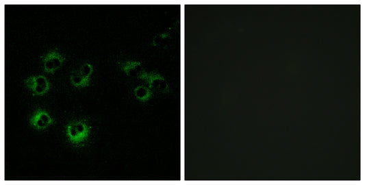 GPR42 Rabbit Polyclonal Antibody