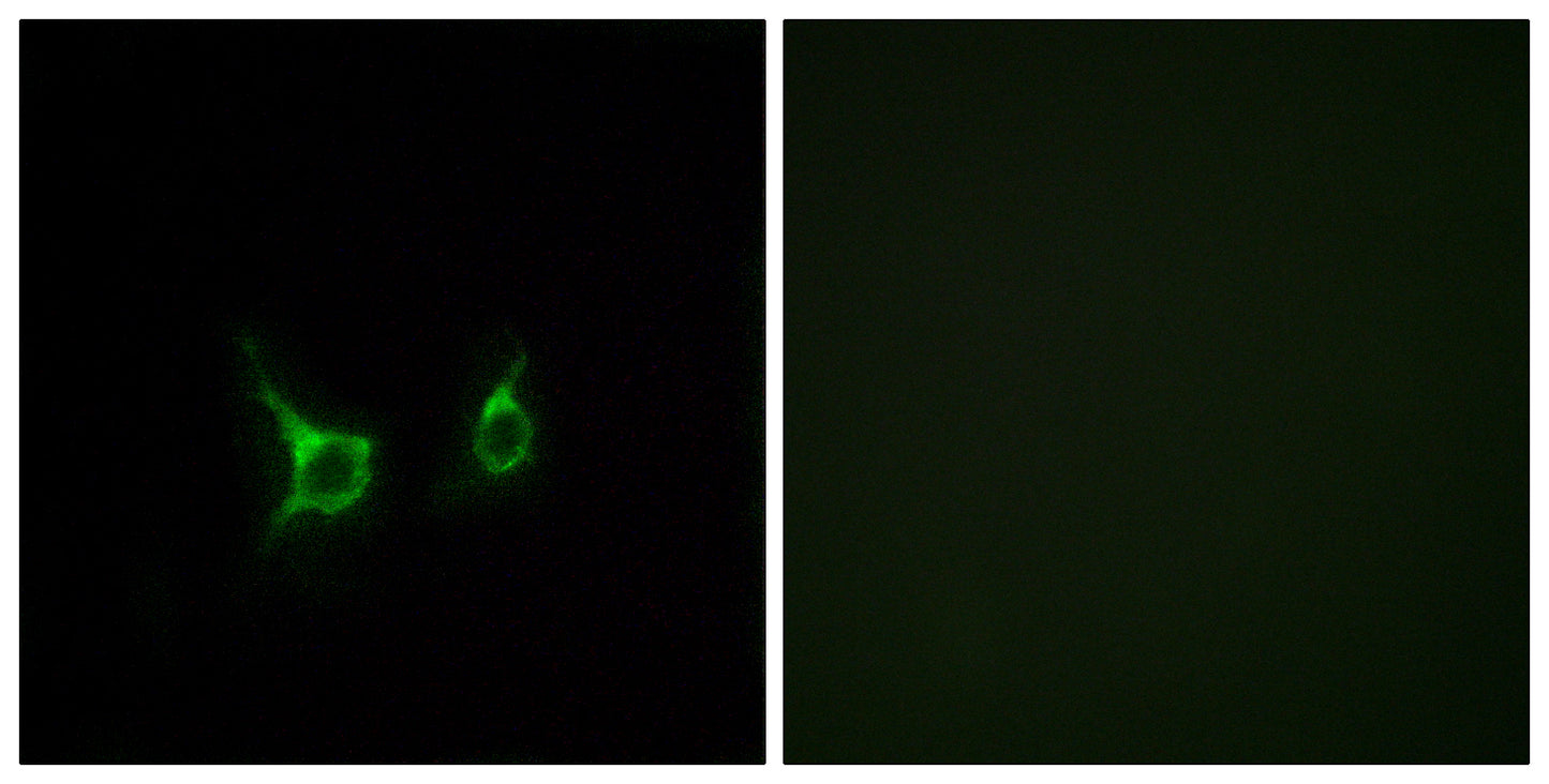 GPR43 Rabbit Polyclonal Antibody