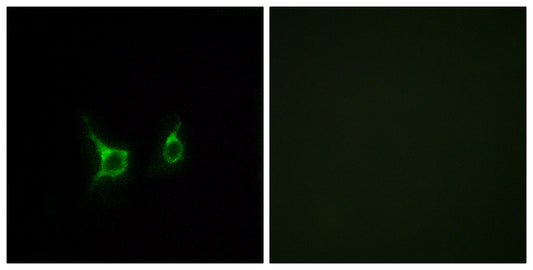 GPR43 Rabbit Polyclonal Antibody