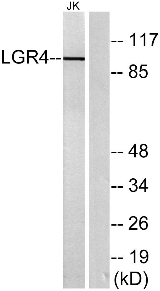 GPR48 Rabbit Polyclonal Antibody