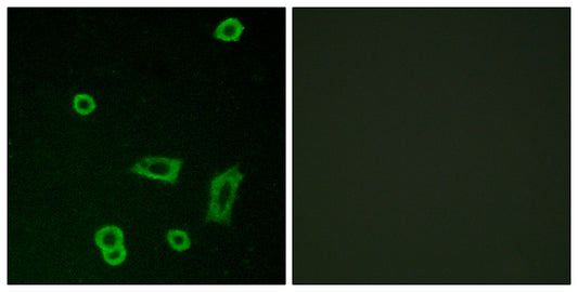 GPR50 Rabbit Polyclonal Antibody