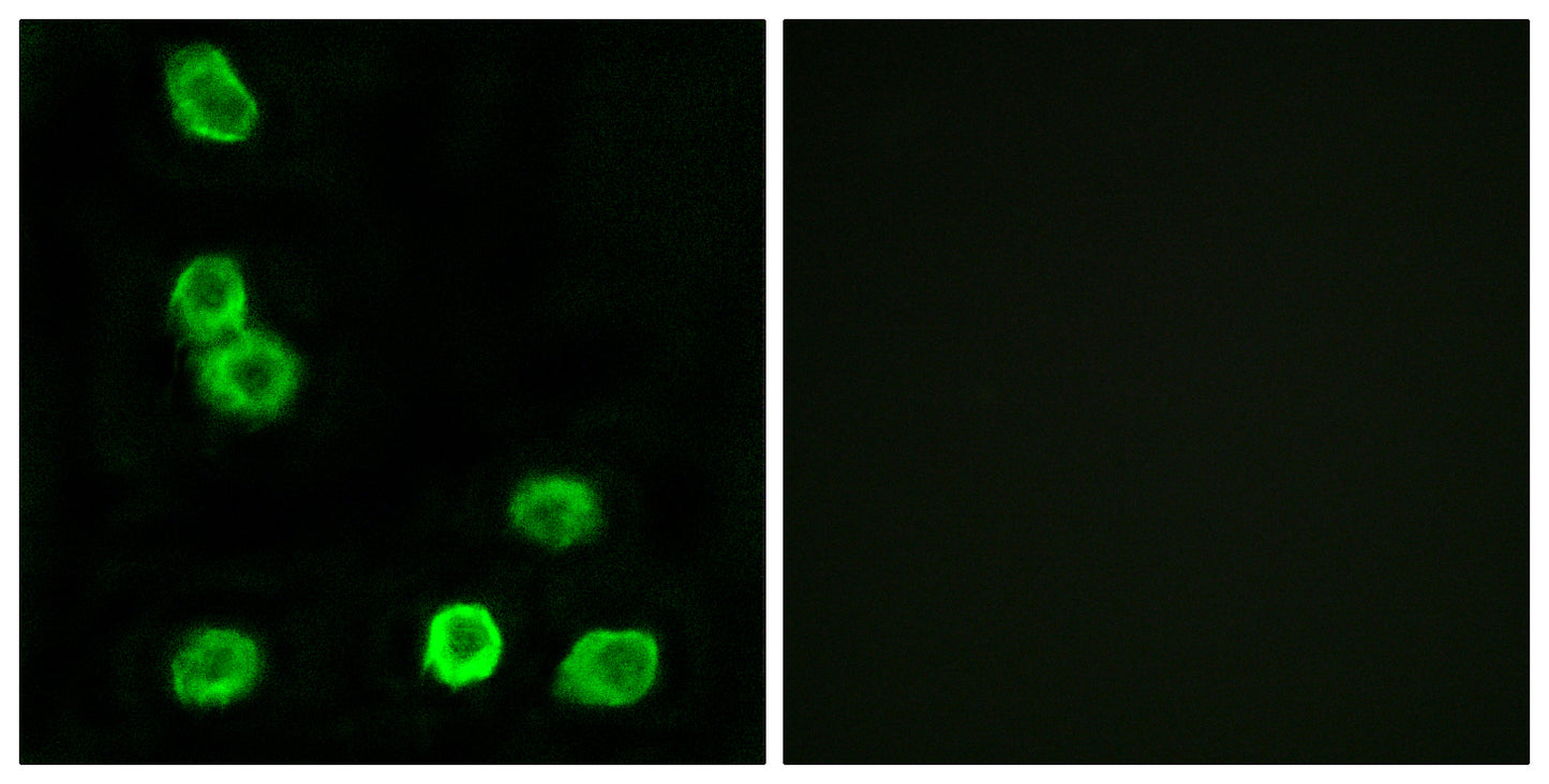 GPR63 Rabbit Polyclonal Antibody