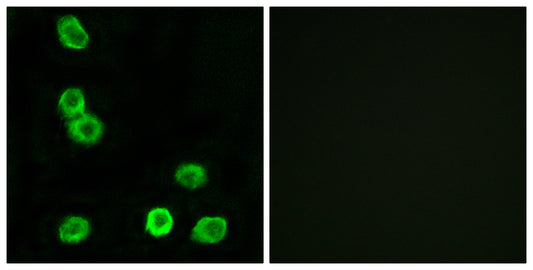 GPR63 Rabbit Polyclonal Antibody