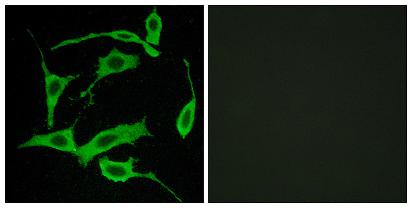 GPR85 Rabbit Polyclonal Antibody