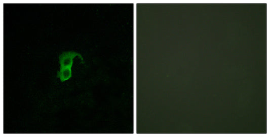 GPR87 Rabbit Polyclonal Antibody