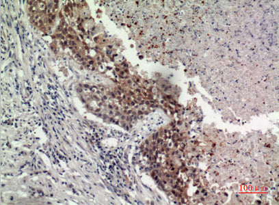 GPR87/95 Rabbit Polyclonal Antibody