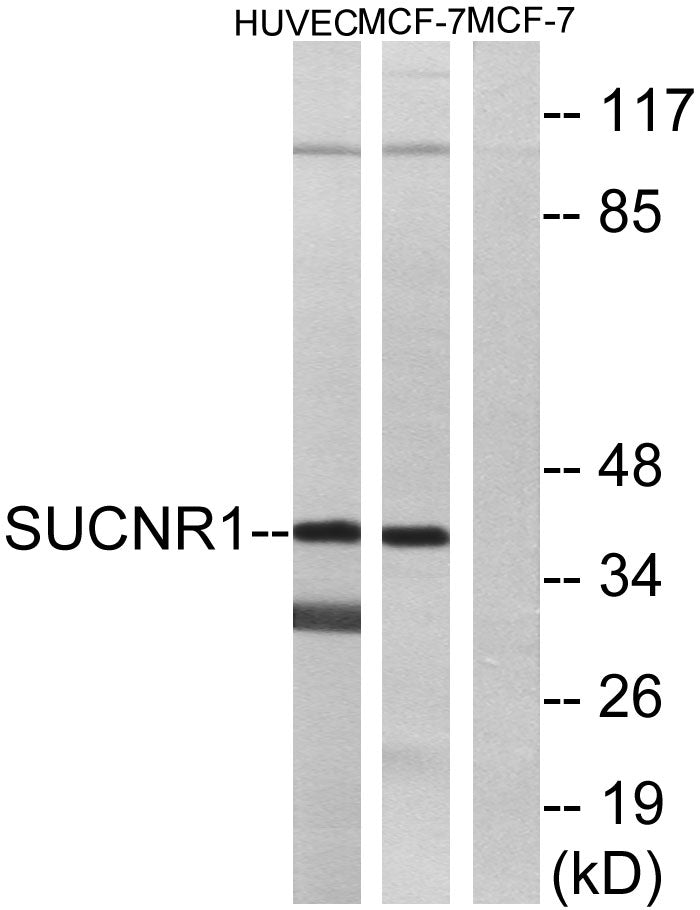 GPR91 Rabbit Polyclonal Antibody