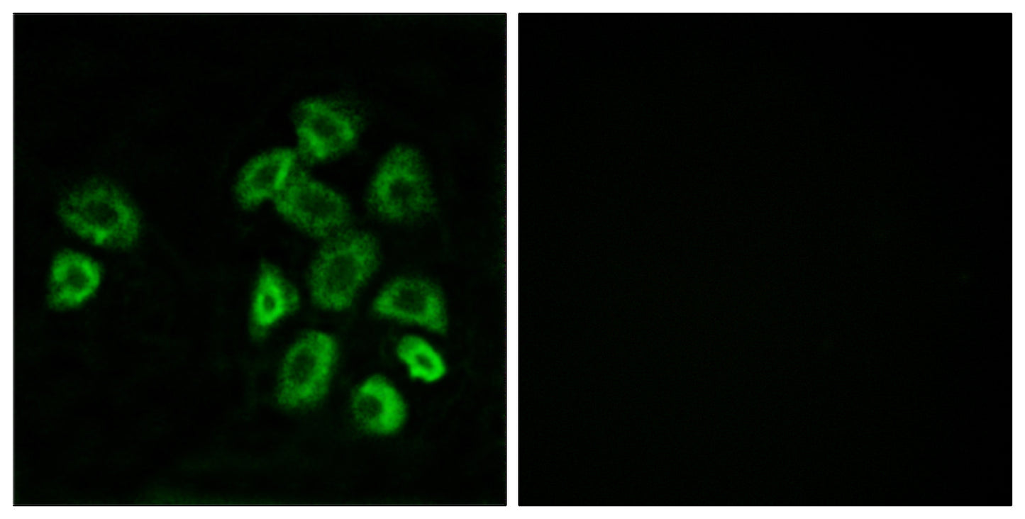 GPRC5B Rabbit Polyclonal Antibody