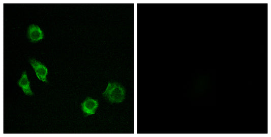 GPRC5D Rabbit Polyclonal Antibody