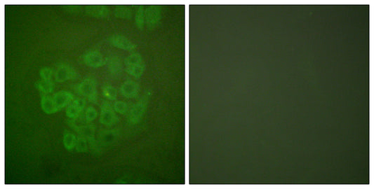 GR Rabbit Polyclonal Antibody