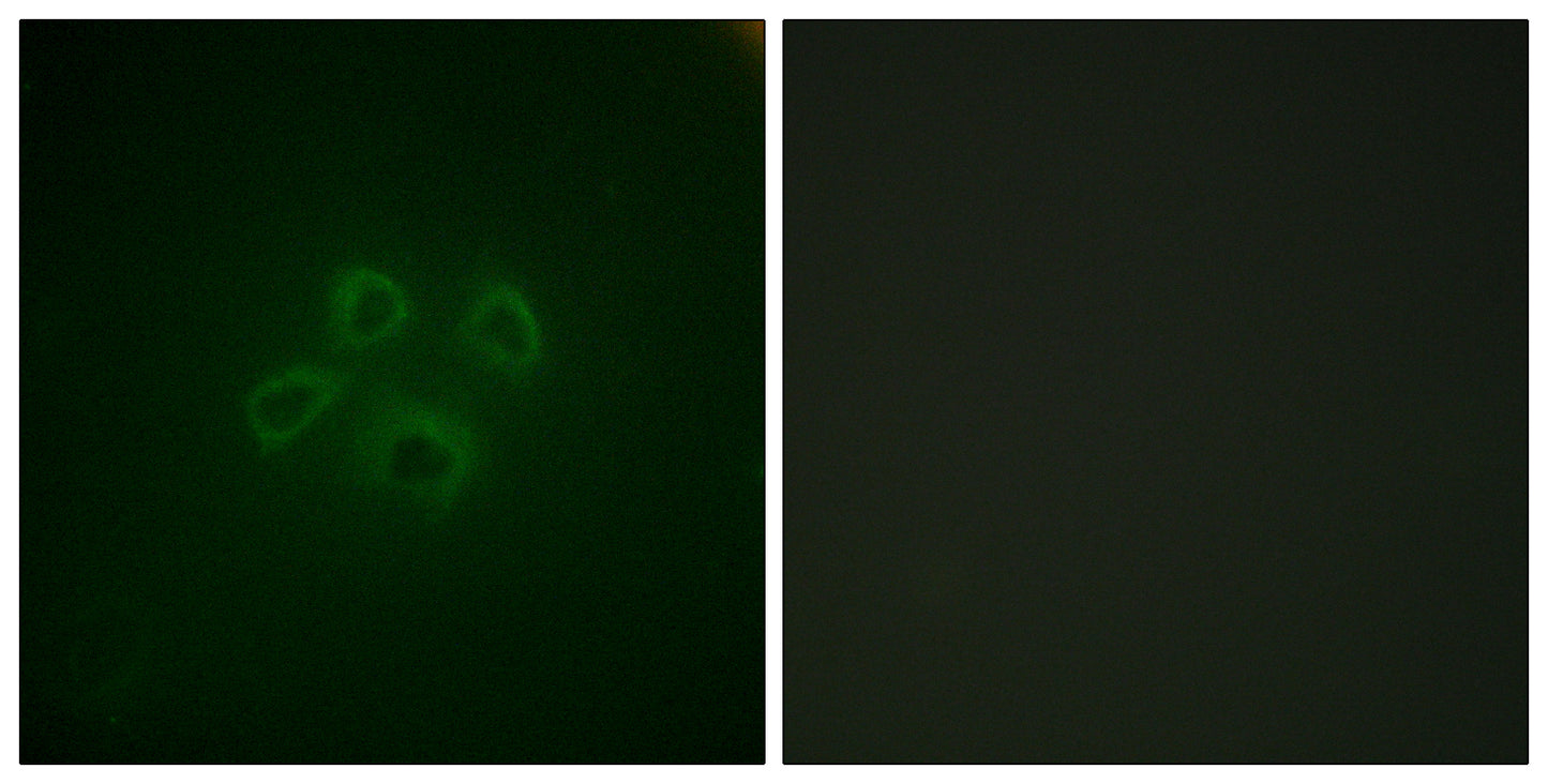 GRB10 Rabbit Polyclonal Antibody