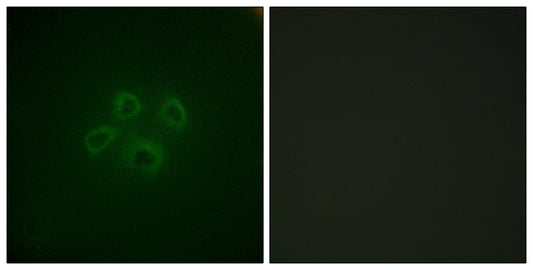 GRB10 Rabbit Polyclonal Antibody