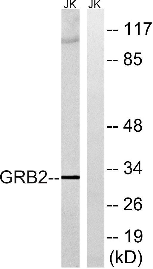 GRB2 Rabbit Polyclonal Antibody