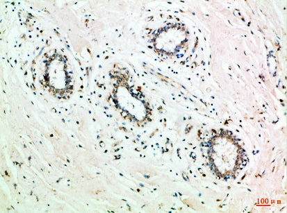 GRB7 Rabbit Polyclonal Antibody