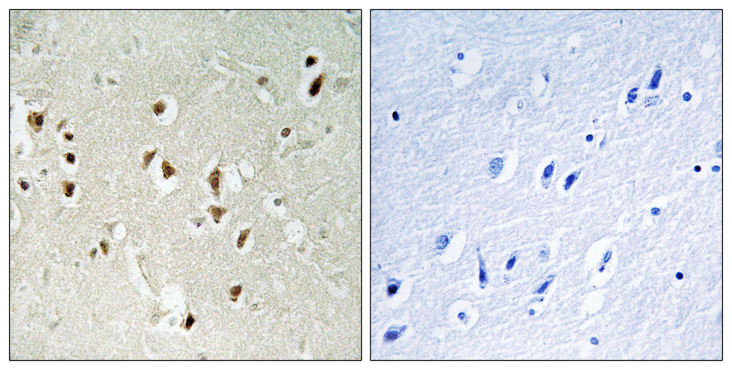 GRF-1 Rabbit Polyclonal Antibody