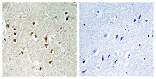 GRF-1 Rabbit Polyclonal Antibody
