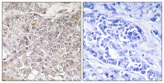 GRIN3 Rabbit Polyclonal Antibody