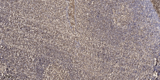 GRIP-1 Rabbit Polyclonal Antibody