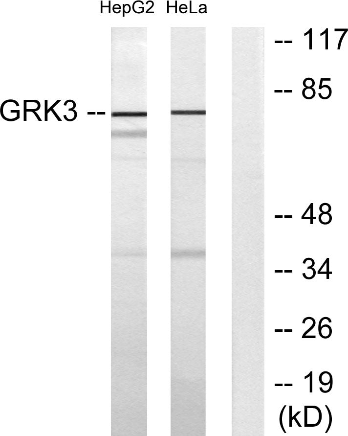 GRK 3 Rabbit Polyclonal Antibody