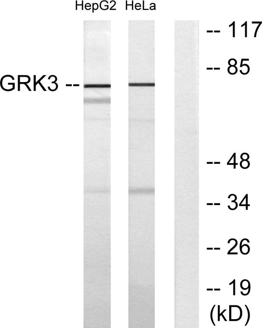 GRK 3 Rabbit Polyclonal Antibody