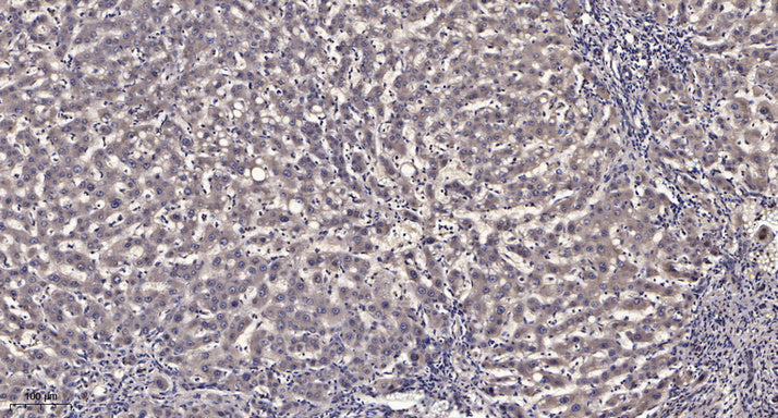 GRK 4 Rabbit Polyclonal Antibody