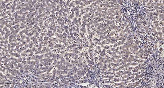 GRK 4 Rabbit Polyclonal Antibody