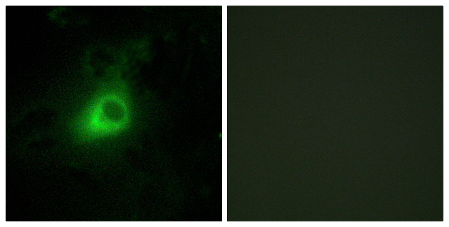 GRK 6 Rabbit Polyclonal Antibody