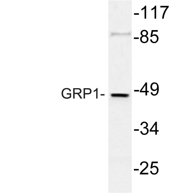 GRP1 Rabbit Polyclonal Antibody
