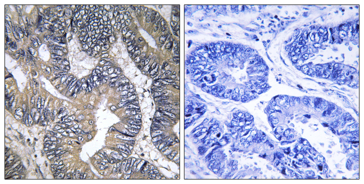 GTPBP2 Rabbit Polyclonal Antibody