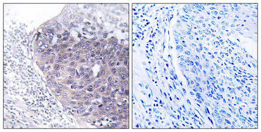 GTPBP5 Rabbit Polyclonal Antibody