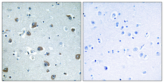 Gα olf Rabbit Polyclonal Antibody