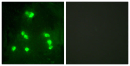 Hairless Rabbit Polyclonal Antibody