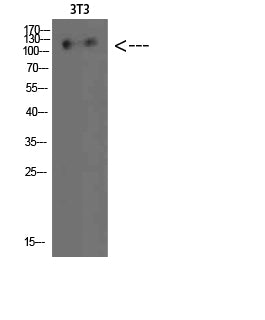 Hamartin Rabbit Polyclonal Antibody