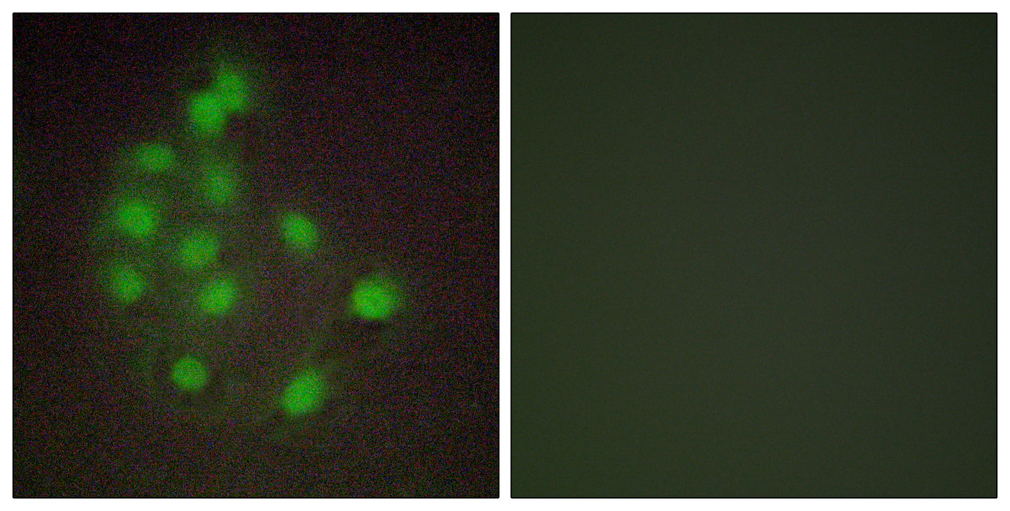 HAND1 Rabbit Polyclonal Antibody